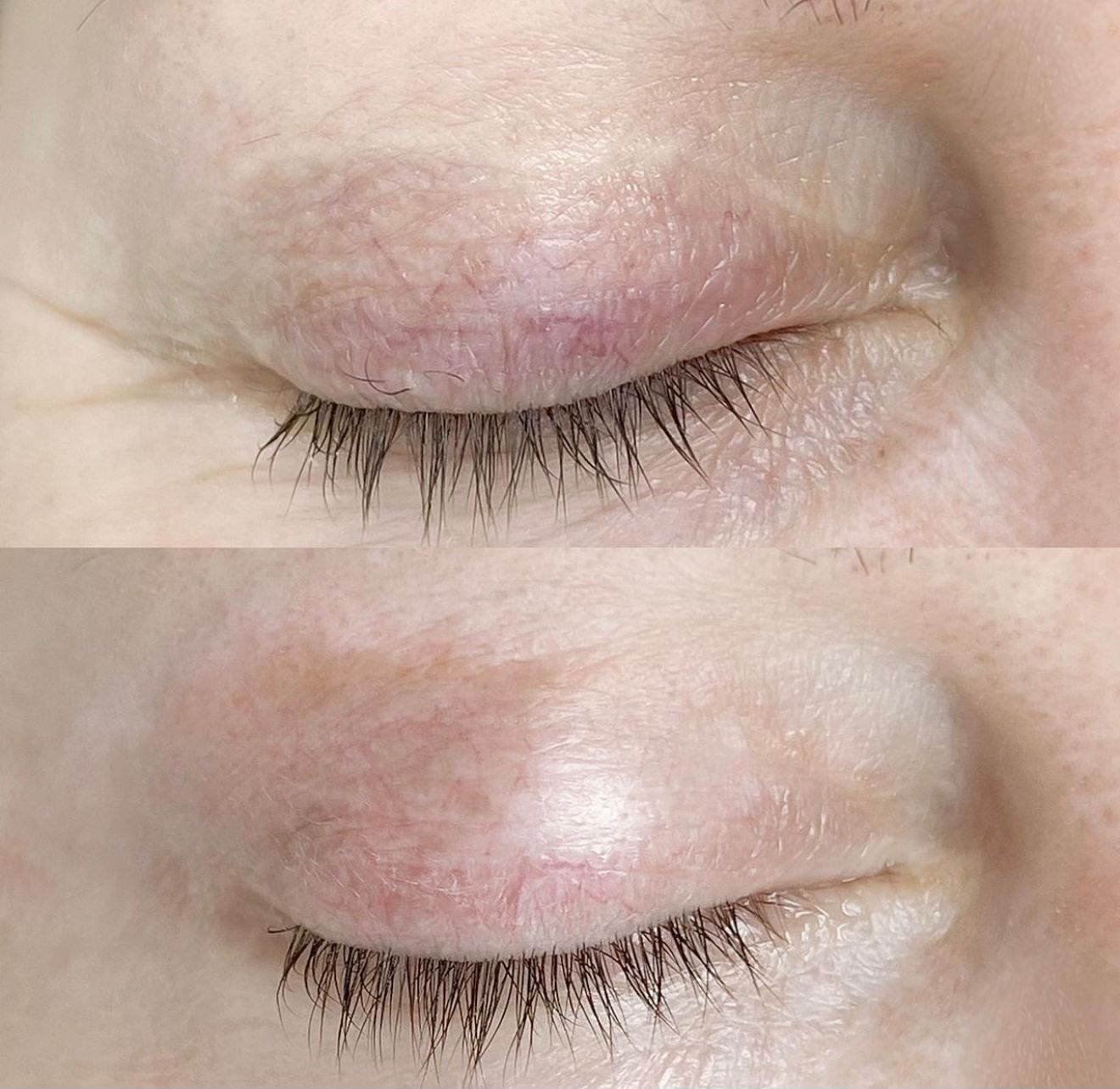 Antes e Depois Camuflagem 3