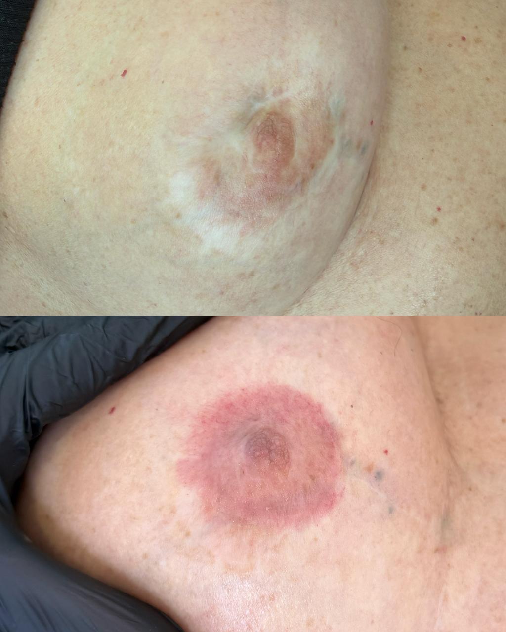 Antes e Depois Camuflagem 6