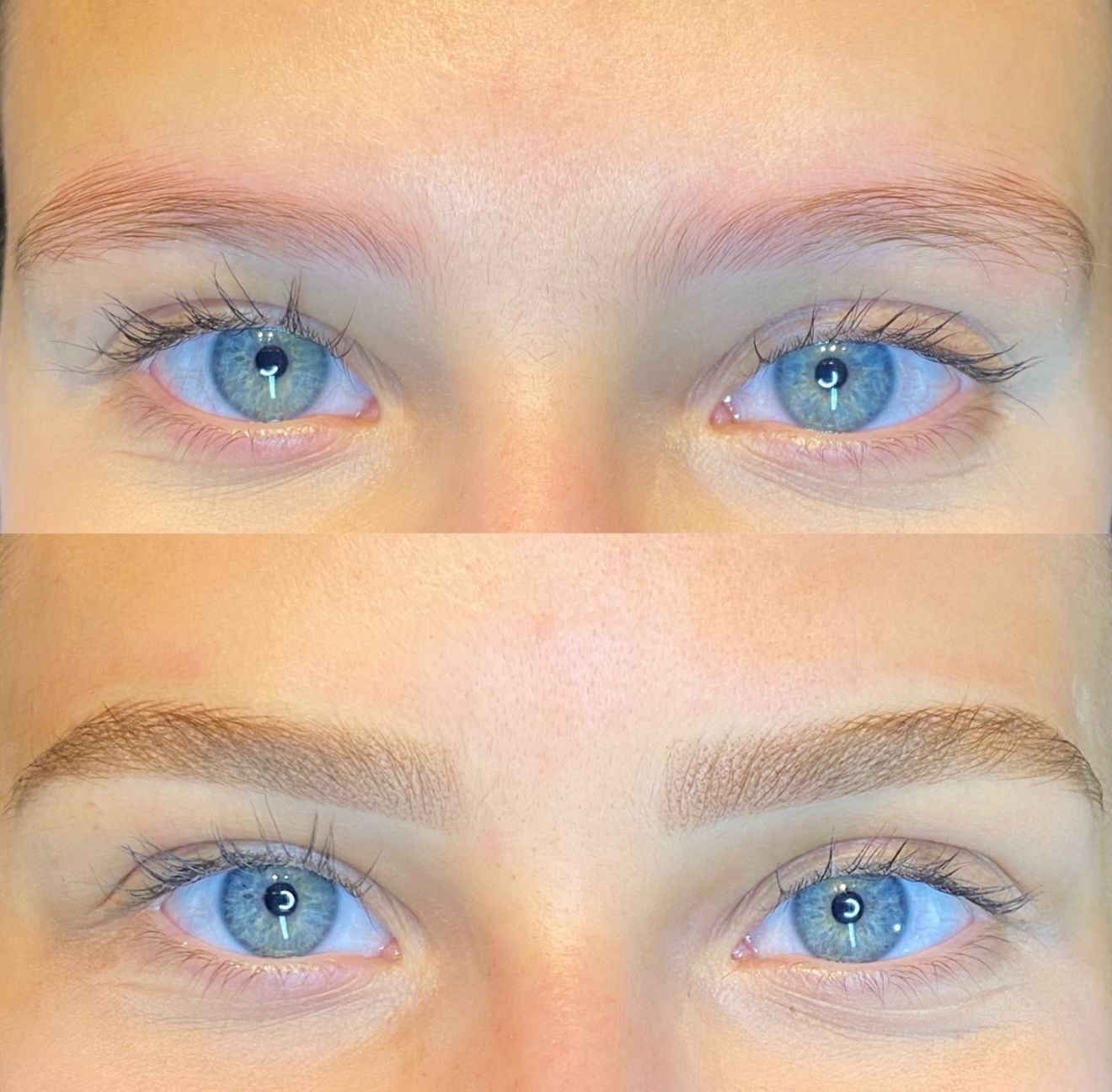 Antes e Depois Sobrancelha 5