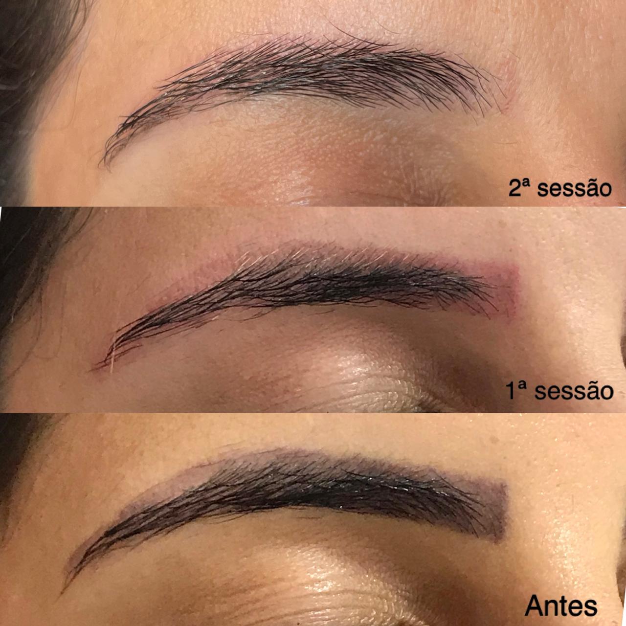 Antes e Depois Sobrancelha 8