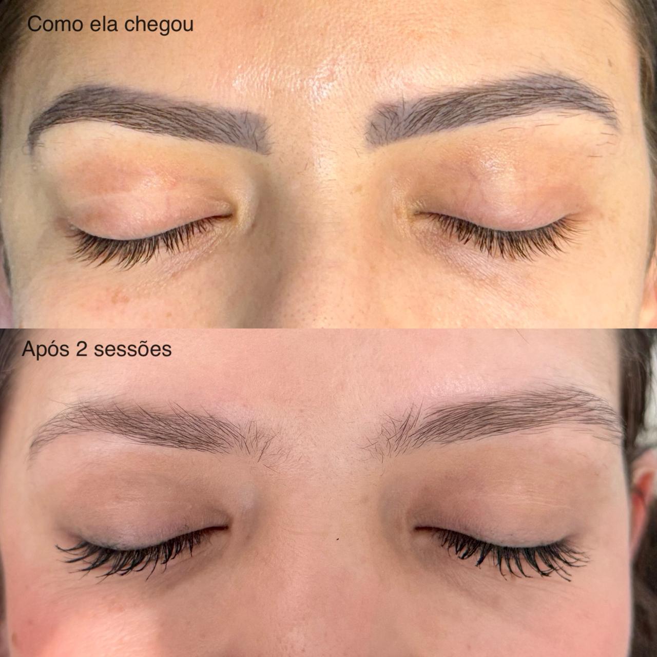 Antes e Depois Sobrancelha 11